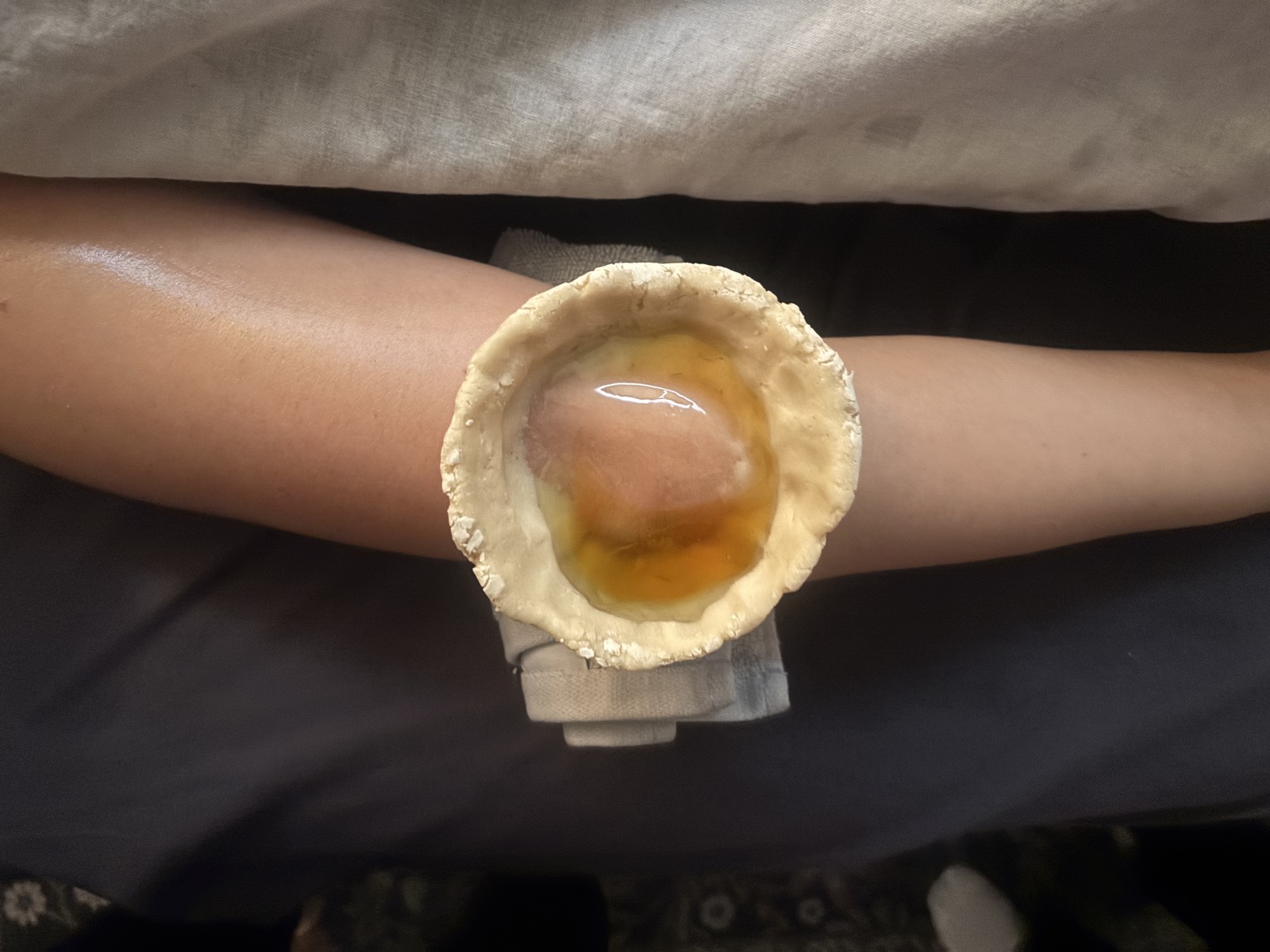 Basti therapy for knee pain