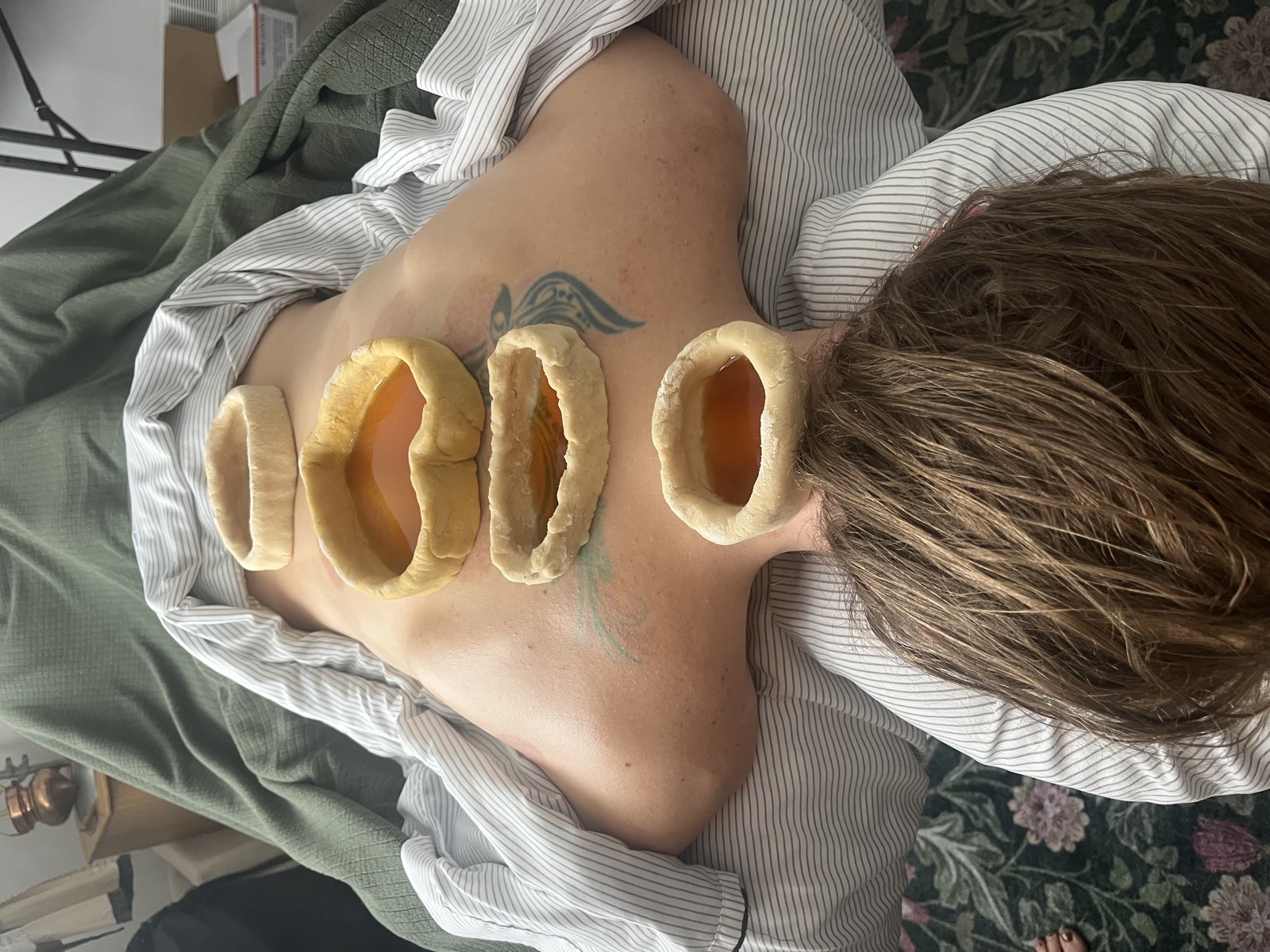 Chakra Basti treatment at Om Maitri